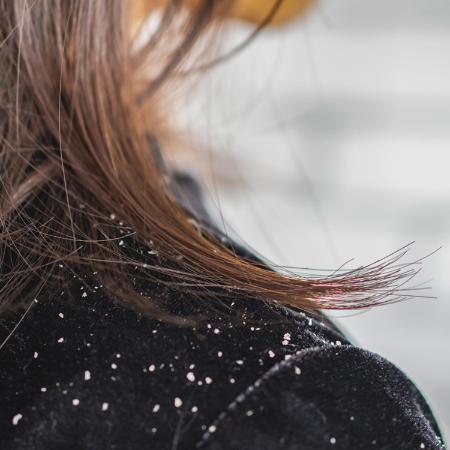 Picture for category Anti-dandruff